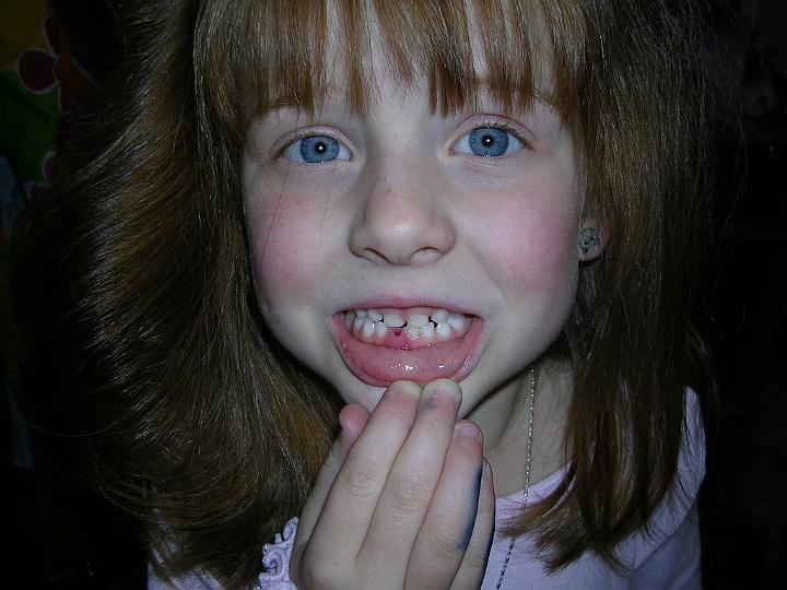 Keely's first missing tooth.JPG